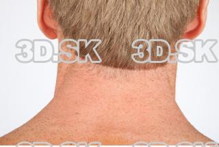 Neck texture of Alberto 0002